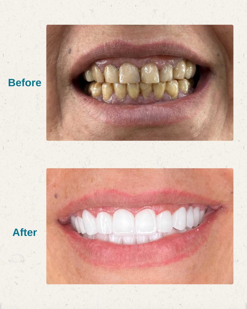 Hollywood Smile IMed Medical