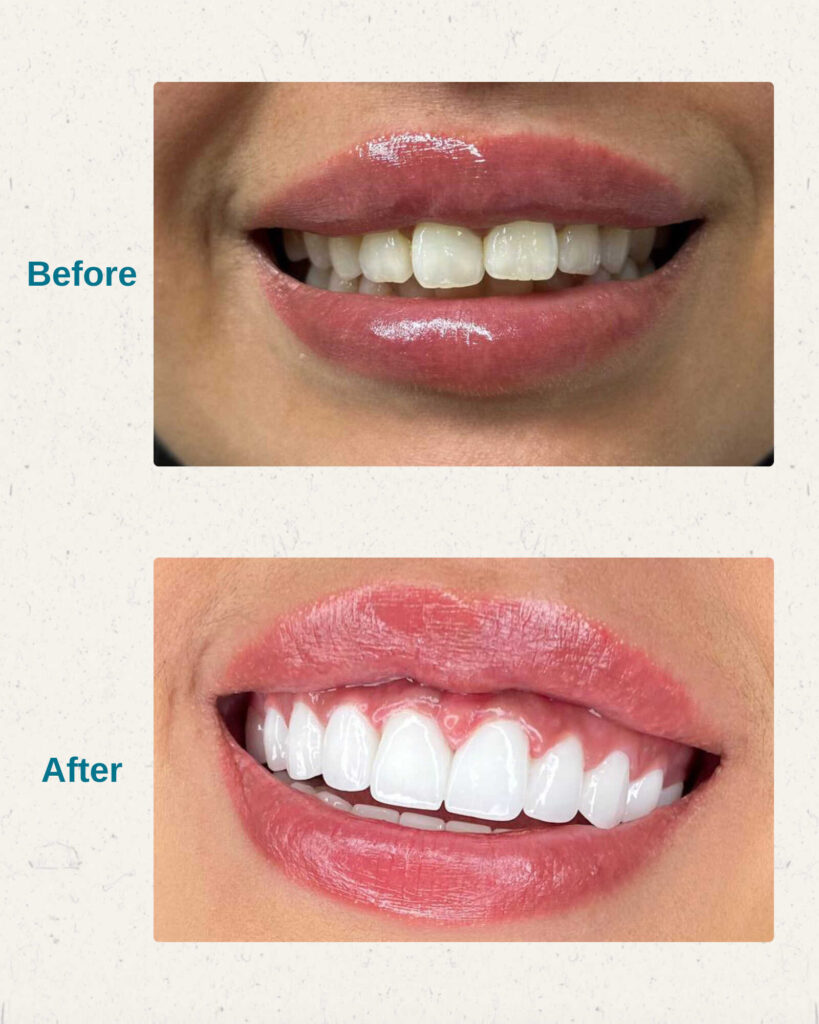 Hollywood Smile IMed Medical